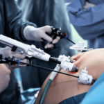 операции при похудении